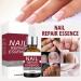 Extra Strong Fungal Nail Treatment - Nail Fungus Remover Kit with File and Brush - 20ml - Buy Online on GoSupps.com