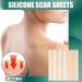 Milageto Plaster for Skin Scars - Reusable & Effective Treatment 15x4cm | International Shipping Available - Buy Online on GoSupps.com