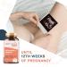 Organic Children's Vitamins for Women | Folic Acid Inositol Q10 B12 & 9 Minerals - 60 Vegetarian Capsules for Fertility & Pregnancy - Buy Online on GoSupps.com