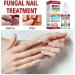 Toenail Repair Solution Extra Strong Finger and Toenail Repair Fluid 10 ml nail repair serums for toenail or fingernail repair and renew nail damage Yunmiao - Buy Online on GoSupps.com