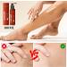 Magic Body Oil 100ml Magic Luxury Body Oil Huile Corporelle Huile De Massage Texture L g re Naturelle Huile De Soin Du Corps R duit Les Ridules Sur Les Joues Abdomen Cuisses Et Bras - Buy Online on GoSupps.com