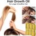 Hair Growth Promoting Oil Natural Organic Hair Growth Oil Essence Fast Natural Hair Growth for Thick and Fluffy Hair Growth  - Buy Online on GoSupps.com