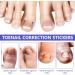 Toen il Correction Sticker 100Pcs: N il Repair P tches Restores Appearance of Discolored or Damaged Nails Foot Care - Buy Online on GoSupps.com