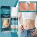  Iouyjiu Scar Cream Burn Repair Skin Healing Intensive Overnight Formula Protective Care Support Tube for Face Tummy Body Arms Legs Women Men Burn Injury Recovery 50ml - Buy Online on GoSupps.com