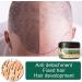 Cr me naturelle de croissance des cheveux au gingembre pommade de croissance des cheveux au gingembre apr s-shampoing anti-perte de cheveux s rum de croissance des cheveux au gingembre huile - Buy Online on GoSupps.com