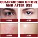 Face Moisturiser - Soothing & Barrier Support Serum 1 oz / 30 ml - Relieves Dry/Tight/Reddened Skin - Buy Online on GoSupps.com