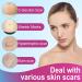 Soothing Silicone Scar Tape Roll - 1.6''x75'' Reusable & Waterproof Treatment for C-Section, Keloids, Acne - Professional Scar Removal Patch - Buy Online on GoSupps.com