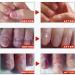 Nail Strengthening Treatment for Damaged Nails Nail Polish Strengthener Nail Hardner Oil Clear Nail Polish Strengthening Nail Growth and Strengthener Extreme Strength Nail Serum Nail Repair Serum - Buy Online on GoSupps.com