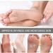 Urea 40% Foot Cream Urea Foot Cream Cracked Heel Repair Cream for Feet And Hand Foot Cream for Cracked Heels and Dry Skin Hard Skin Remover Foot Cream for Hand Foot and Body Care - Buy Online on GoSupps.com