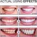 3 Days Purple Teeth Whitening Powder Teeth Whitening Powder for White Teeth Teeth Whitening and Bleaching Powder with Visible Cleaning Effect | Whiten Teeth - Cosmetic Teeth Cleaning (1) - Buy Online on GoSupps.com