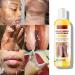 Extra Strong Peeling Oil - Chemical Exfoliant for Face & Body | Reduces Wrinkles Stretch Marks & Dead Skin - Buy Online on GoSupps.com