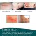 Silicone Scar Sheets Roll-3M (1.6 x 120) for Surgery Burn Keloid Acne - Professional Reusable Strips for C-Section - Scar Removal Tape - Buy Online on GoSupps.com