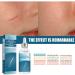 Scar Repairing Serum 30ml - Gentle Scar Removal for All Skin Types - Buy Online on GoSupps.com