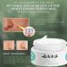 Saam Face Cream Dr Hancy White Spot Cream White Spot Cream China Saam Cosmetic Cream Moisturizing and Repairing Cream (5PCS) - Buy Online on GoSupps.com