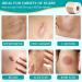Emibele Silicone Scar Sheets 1.6x120 Roll-3M | Professional Scar Tape for Keloid, Acne, Surgery Scars | Soft & Breathable Silicone Gel Strip for Scar Removal - Buy Online on GoSupps.com