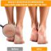 12 PCS Stainless Steel Foot Grater Set - Professional Callus Remover for Feet - Buy Online on GoSupps.com
