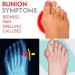 Women's Orthopedic Bunion Corrector Sandals - Summer Rhinestone Slip-On Wedge - Open Toe Breathable Flip Flops for Beach & Plantar Fasciitis - 5 Colors Including Pink - Buy Online on GoSupps.com