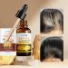 Sadoer Ginger Anti-Hair Loss Oil & Shampoo Set | Hair Growth Serum for Thicker Stronger Hair | Men's & Women's Treatment - Buy Online on GoSupps.com
