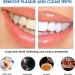 Elunara Bandes de blanchiment des dents blanches 5D bandes blanches de blanchiment des dents bandes blanches efficaces sensibilit r duite sans sensibilit id ales pour les voyages (2) - Buy Online on GoSupps.com