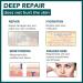 MIELIKKI Silicone Scar Sheets - Reusable 1.6x120 Roll for Scar Removal from Acne, C-Sections, Burns, and Surgery - Post Surgery Supplies - Buy Online on GoSupps.com
