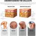DUBUSH Bodyslim Firming Gel Body Shaping Cream Firming Body Cream Firming Tummy Anti Cellulite Firming Loose Skin - Buy Online on GoSupps.com