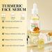 Turmeric Serum Dark Spots 30 ml Spot Corrector Face & Body Anti Aging and Wrinkle Face Serum Reduces Hyperpigtation Age Spots Sun Spot Improve Skin Tone Moisturize Brighten All Types - Buy Online on GoSupps.com