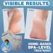 TEAWOO 6 Pairs Moisturizing Heel Socks for Cracked Heel Treatment Foot Care Toeless Socks to Soften and Hydrate Dry Cracked Feet Heels Cracked Heel Repair Socks Gel Socks for Dry Cracked Feet White/Grey/Black - Buy Online on GoSupps.com