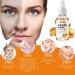 Turmeric Serum for Dark Spots Removal Turmeric Dark Spot Corrector Serum for Face & Body Turmeric Oil Age Spot Corrector Skin Care Moisturizing Serum - Buy Online on GoSupps.com
