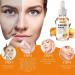 Turmeric Dark Spot Corrector Serum - 1 Fl Oz | Reduce Hyperpigmentation & Age Spots | Improve Skin Tone for Men & Women | All Skin Types - Buy Online on GoSupps.com