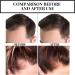 2PCS Suna Plant Extract Hair Growth Oil S rum De Croissance des Cheveux Huile De Repousse des Cheveux Au Gingembre S rum anti-chute de cheveux Hair Growth Serum S rum booster de croissance des cheveux - Buy Online on GoSupps.com