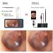 BAIXDM Digital Otoscope Camera - 4.5 HD Screen 3.9mm Ear Scope with Light Photo & Video Recording - Buy Online on GoSupps.com