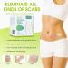 Silicone Scar Sheets 1.6 x 60 Roll - Effective Silicone Gel Tape for Scar Removal - C-Section, Keloid, Burn & Acne - 1.5M Roll - Buy Online on GoSupps.com