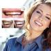 Teeth Gloss & Whitening Pen - Instant Stain Removal & Gentle Dental Cleaning | Abbey Teeth Whitening - Buy Online on GoSupps.com