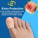 Big Toe Protectors (10PCS) - Breathable Gel Toe Sleeves for Corns Calluses & Hammer Toe - Aloe Vera Infused Comfort - Buy Online on GoSupps.com
