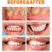 Ampoule Teeth Whitening Serum | Gum Repair & Enamel Restoration - 3 Boxes - Buy Online on GoSupps.com