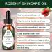 Nature Jade Stone Gua Sha Massage Tools Set with Rosehip Oil | Skin Beauty and Moisturizing | Includes Travel Pouch | Green Jade Stone & 30ml Rosehip Oil - Buy Online on GoSupps.com