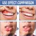 2pcs Toothache Relieving Spray Herbal Oralcare Spray Toothache Pain Relief Dental Pain Relief Spray Toothache Pain Relief for Adult Instant Teeth Treatment Relief Strong Pain Relief for Toothache - Buy Online on GoSupps.com