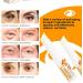 Hengxuan Lumibalm for under the eye bags Lumistick Eye Serum Turmeric Retinol Eye Cream Stick Turmeric eye cream for bags and eye bags reduces fine lines 1 piece - Buy Online on GoSupps.com