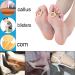 Felt Callus Pads & Foam Cushions Set - 6 Felt Pads & 45 Foam Toe Pads for Pain Relief & Protection | Comfortable Corn Cushions - International Shipping - Buy Online on GoSupps.com