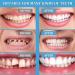 Perfect Smile Dentures Pebbles - Cosmetic Veneers & Temporary Prostheses for Men & Women | 6 Pairs of Reusable Tooth Whitener - Buy Online on GoSupps.com