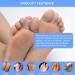 DYKOOK Gel Toe Sleeve - 10 Pcs Silicone Tubes for Blister, Callus, Corn, and Toe Rubbing Treatment - Toe Protector for Men and Women - Buy Online on GoSupps.com