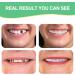 Snap-On Denture Smile Braces for Men and Women - Enhance Your Smile! - Buy Online on GoSupps.com
