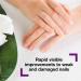 Emtrix Nail Renewal with Tea Tree Oil | Nail Strengthener for Damaged Nails | Healthy Nail Growth | Vegan | 10ml - Buy Online on GoSupps.com
