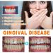 Repair Ampoules Removing Tartar And Plaque And Various Oral Problems 10.5ml - Buy Online on GoSupps.com