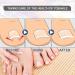 MFCGHXR Nail Care Toenail Correction Patch Set of 124 Includes Patch Nail Stickers File Lifter & Remover Black L - Buy Online on GoSupps.com