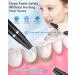 Ultrasonic Tooth Cleaner - Plaque Remover with 5 Adjustable Modes and LED - Safe & Effective Teeth Stain and Tarter Removal (Black) - Buy Online on GoSupps.com