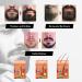 Premium Bart Set - Complete Beard Care Kit | Includes Bart Balsam Bart l & Bartshampoo | Perfect Gift for Men | International Shipping Available - Buy Online on GoSupps.com