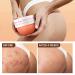 Butt Acne Clearing Treatment, Body Cream for Back, Buttocks, Thigh & Chest Acne, Skin Clearing Lotion for Men & Women 5.46 oz - Buy Online on GoSupps.com