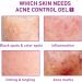 Lot de 3 cr mes pour Las Manchas de La Cara Cremas para Quitar Manchas de La Cara Crema Blanqueadora para Pecas Elimina el Melasma Manchas Oscuras Aclara La Piel - Buy Online on GoSupps.com