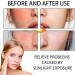 Bio Sunblock Stick SPF 50 PA+++ Sun Block Sticks For Face Body All Day Sun Cream SPF 50 Face Moisturiser Portable Bio UV Protection Sunscreen Stick With Vitamin C Beach Defense Water-Resistant - Buy Online on GoSupps.com